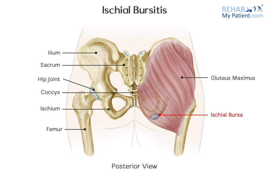 Ischial Tuberosity Sitting Bones Seat Cushion 