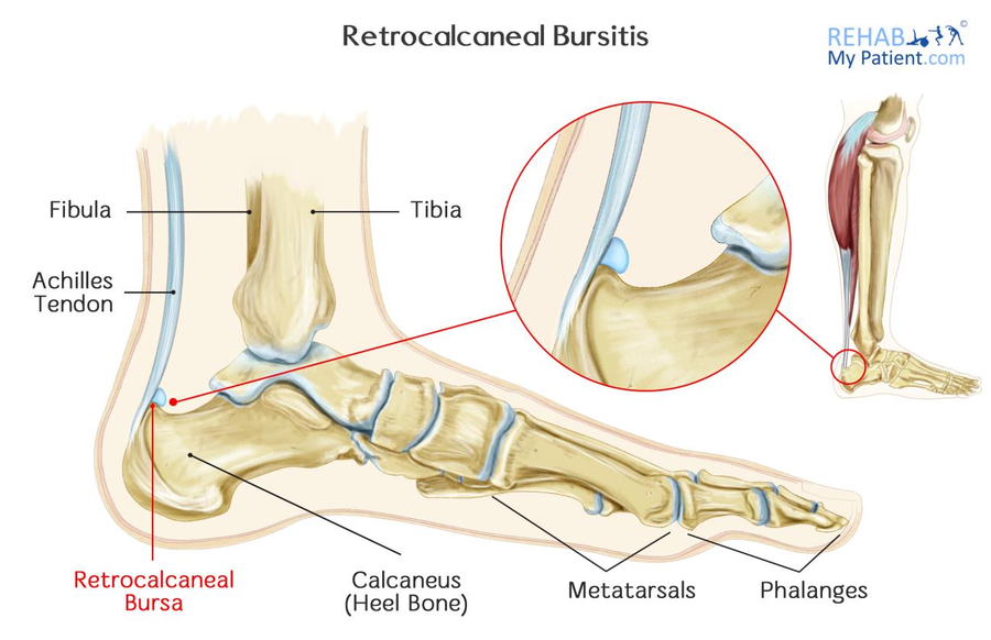 crăpături la nivelul genunchiului și durere în dureri la nivelul cotului și articulației carpiene