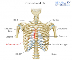 Thoracic Spine articles | Rehab My Patient