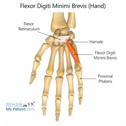 Flexor Digiti Minimi Brevis (hand)