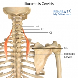 Iliocostalis Cervicis