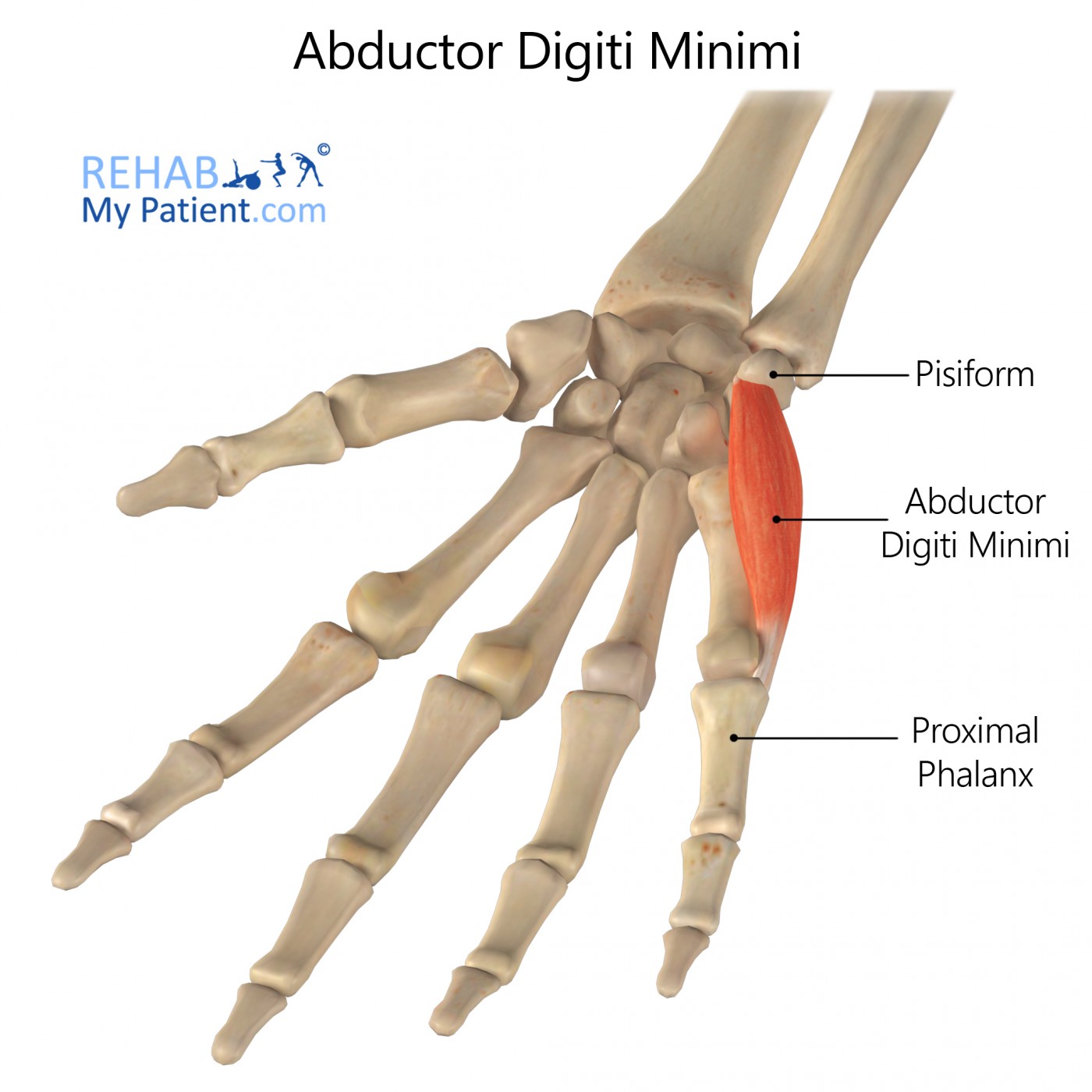 An Atypical Injury Distal to the Palmar Arch