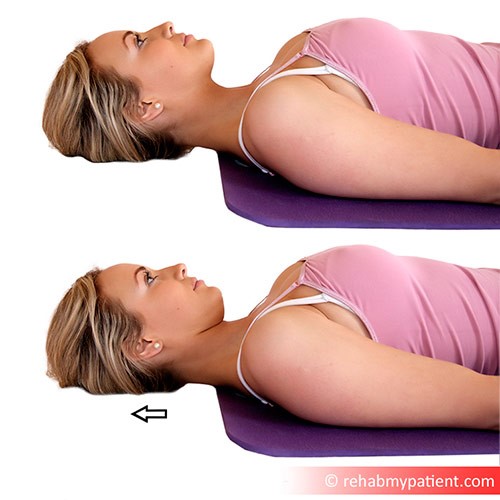 The chin tuck exercise