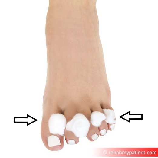 Toe adduction squeeze