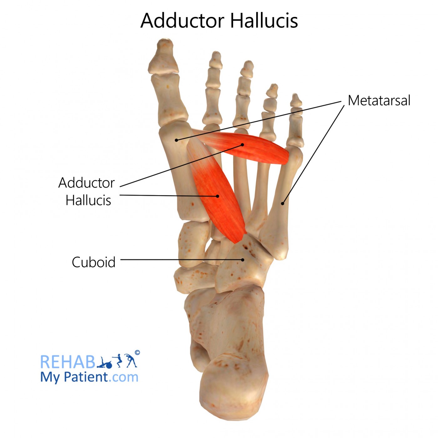 Adductor Hallucis | Rehab My Patient