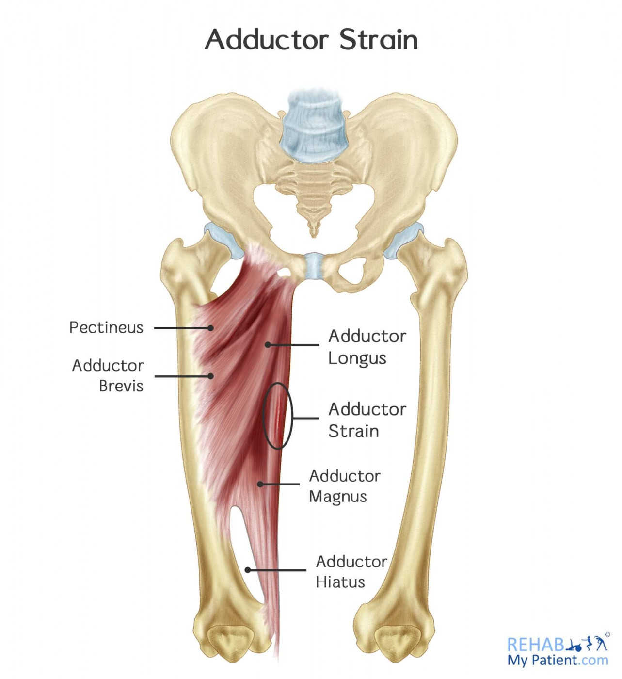 Hip Adductor Strain Rehab My Patient