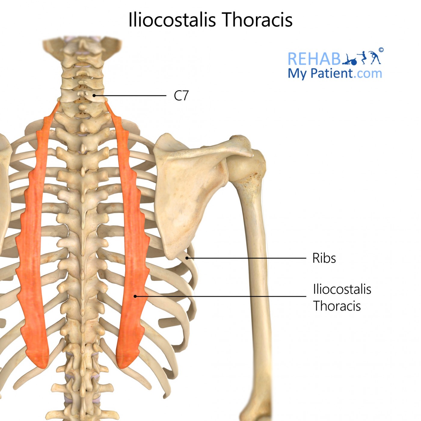Iliocostalis Thoracis